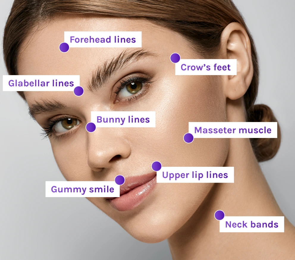 Botox Injections Areas Banner