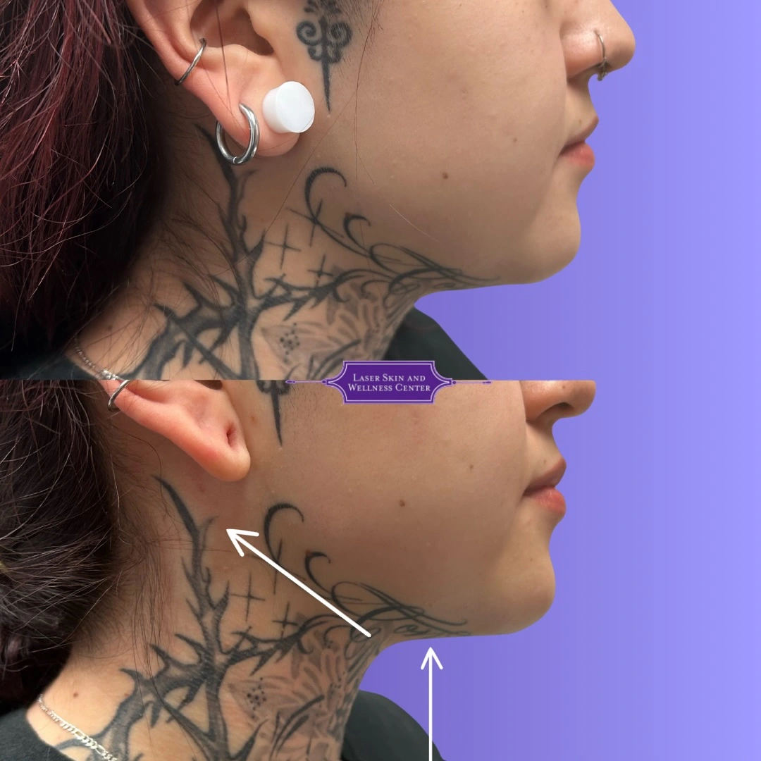 Oligio Case 3 (3)