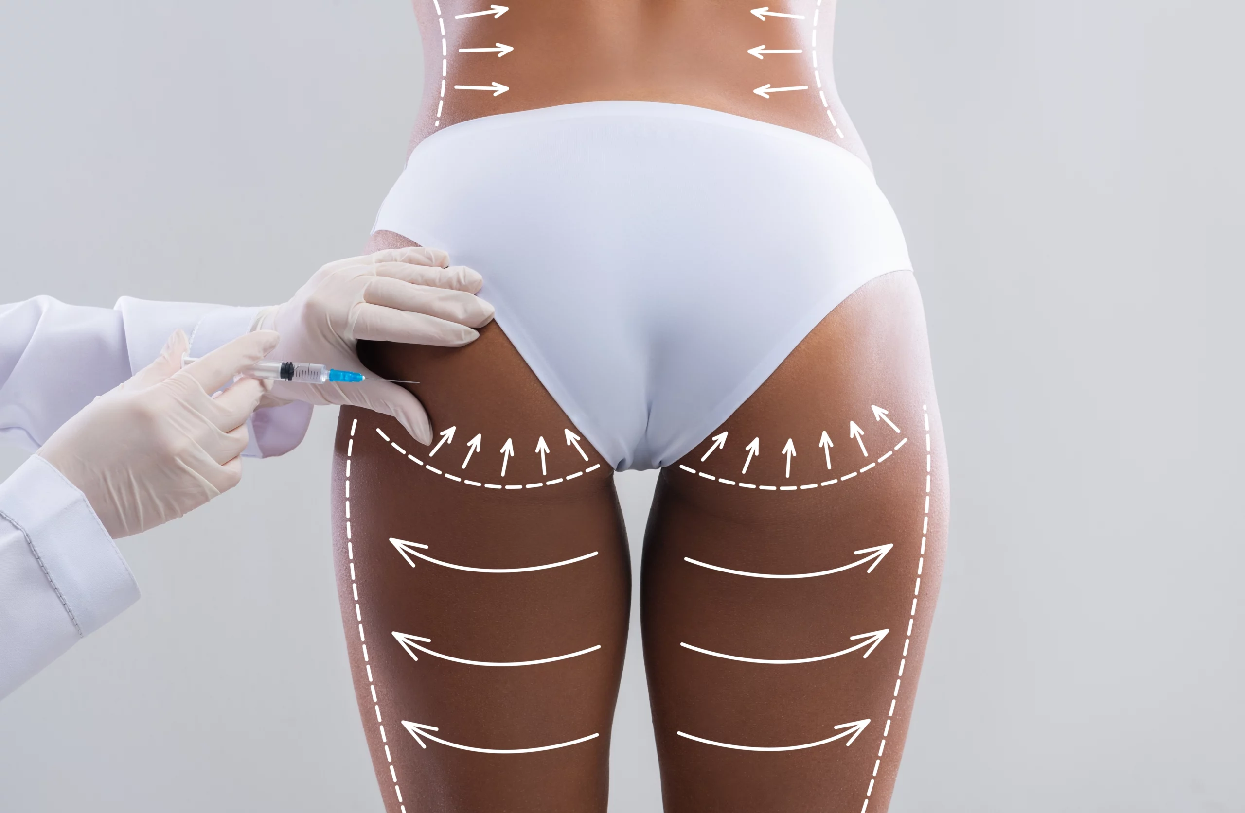 Can a Liquid BBL Give the Same Results as Surgery?